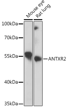 Antxr2 Polyklonaler Antikörper